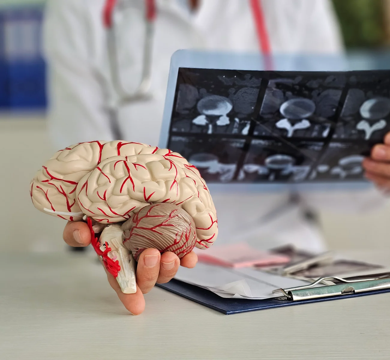 Neurologische Erkrankungen